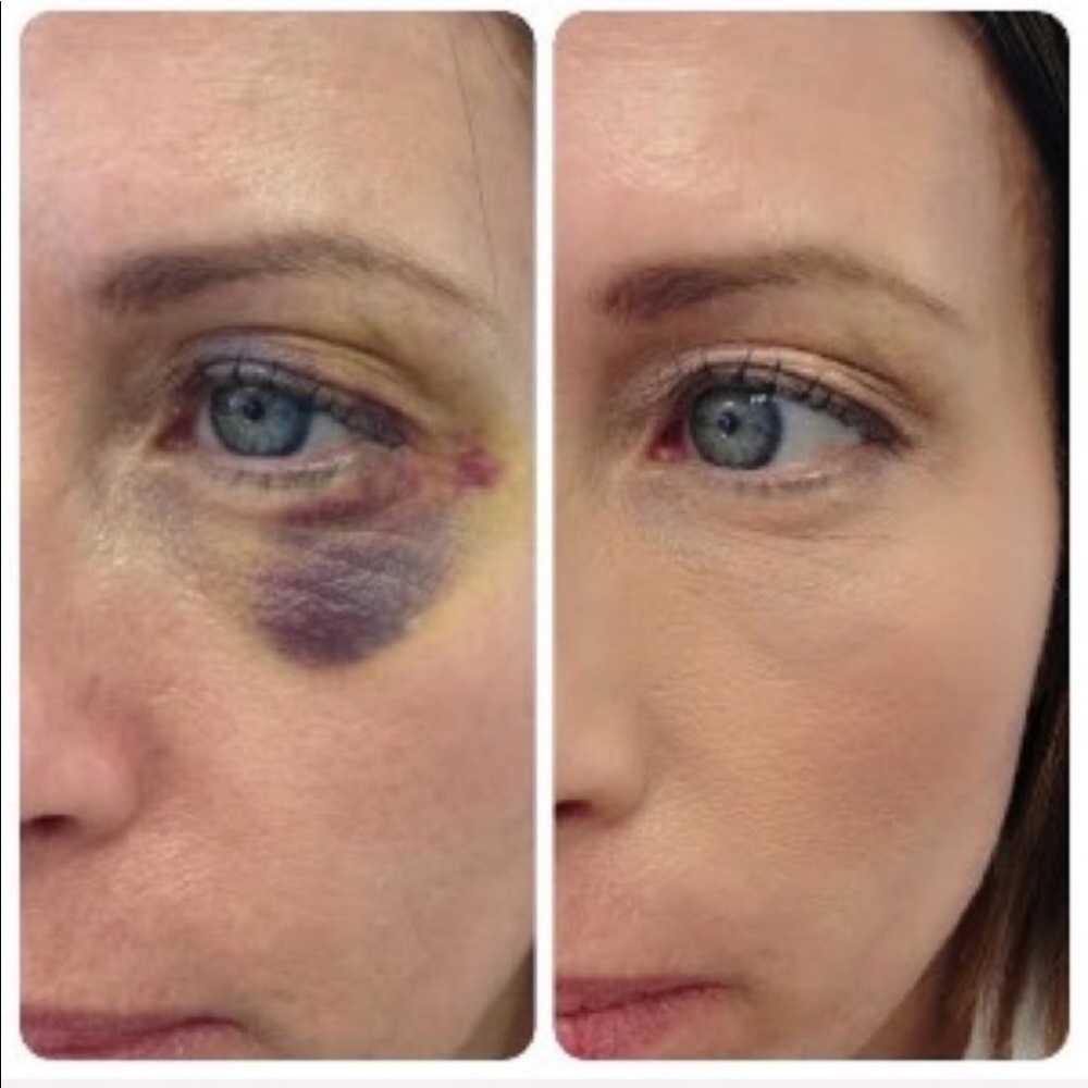 Corrective Colors Jane Iredale - Picture 3 of 8